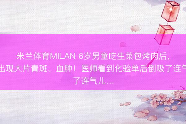 米兰体育MILAN 6岁男童吃生菜包烤肉后,全身出现大片青斑、血肿!医师看到化验单后倒吸了连气儿…